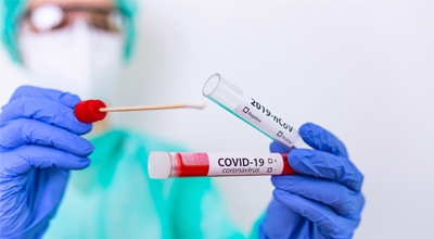 Anticipo orario di  inizio operazioni di screening Covid-19 del 24.11.2020